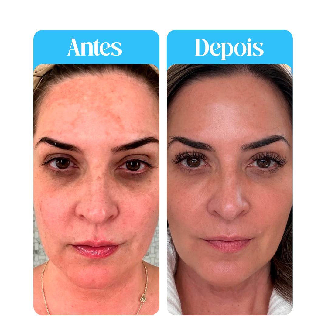 Glow up® - Mascara de colágeno BioAqua