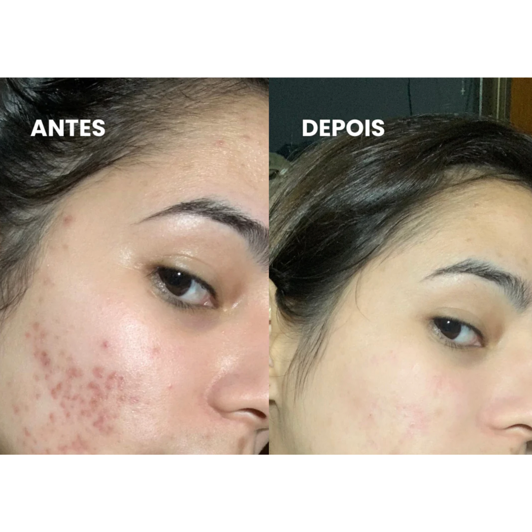 Kit Skin Care Milk - Hidratante & Suavizante Pele [+ PROTETOR SOLAR FPS50]