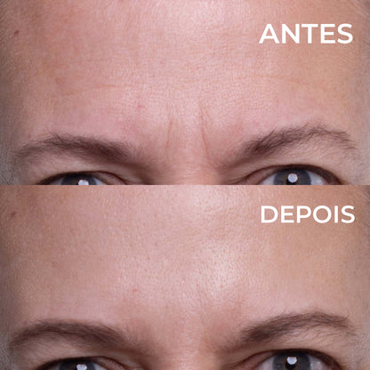 Plaquinhas Anti-Rugas Aquaderma® Testa, olhos e queixo